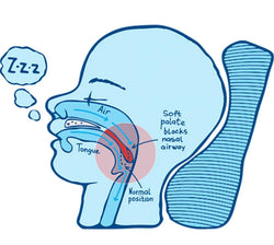 You need to know the reason for snoring